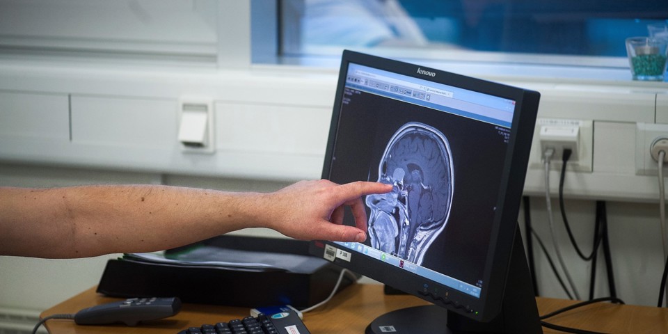 Ultralydsscanning af en hjerne bliver vist på en computerskærm, mens en mand peger på computerskærmen.