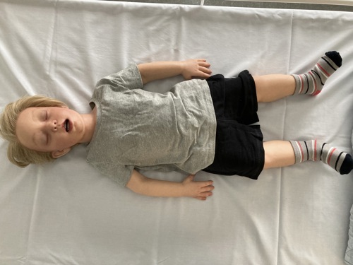 Anders - Hyper realistisk pædiatrisk 3 årig simulator, dreng