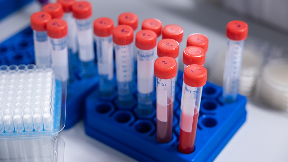 Foto af blodprøverør